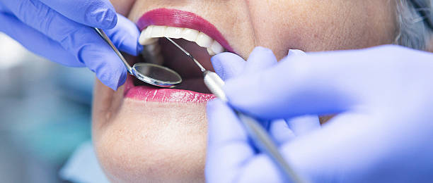 Best Dental Abscess Treatment in East Rochester, NY